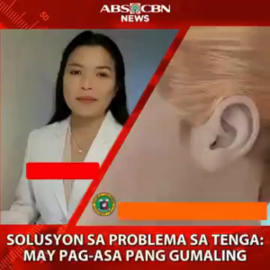 Hearing Aid Softgel l Enhance Earing Problems l For Better communication l Heal Ear Infections l 1 Bottle - 100 Softgels