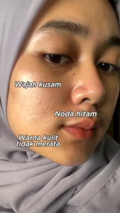 Amura Bright Enhancing Serum Wajah: Solusi untuk Kulit Dewasa Lebih Cerah & Memudarkan Flek Hitam
