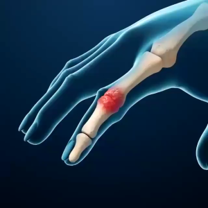 Kem nọc ong 20g Gel trị liệu khớp và dưỡng xương chân tay cánh tay bàn chân hiệu quả