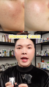 Kem Nám Mommy Care Perilla Whitening Cream - Hỗ Trợ Giảm Nám Tàn Nhang Dưỡng Trắng Da