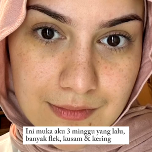 POLYNIA | CREAM MASK | ANTI AGING | PUDARKAN BEKAS JERAWAT | REDAKAN KEMERAHAN | LEMBAB INTENSIF | BPOM