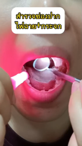 ส่งไว อุปกรณ์กำจัดนิ่วทอนซิล นิ่วทอมซิน สาเหตุกลิ่นปากเหม็นนิ่วทอลซิน  กลิ่นปากแรง ไซริ้งฉีดฟันคุด ไซริ้งปลายโค้ง 12 ml กำจัดกลิ่นปาก ก้อนเหม็นในช่องปาก พร้อมส่งจาก กทมOrangee - Lazada