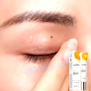 SADOER Eye Cream Anti Aging 20g: Memudarkan Lingkaran Hitam Mata & Menghilangkan Keriput