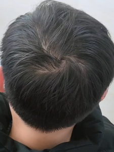 Wig mens short hair hair size mens hair patch head top retouch natural traceless invisible wig piece real human hair thin