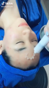 Mặt Nạ Thải Độc CO2 DJ Carborn Therapy Ngăn Ngừa Mụn