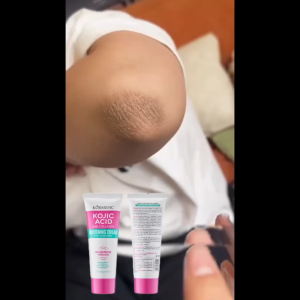 Kojic Acid Underarm Whitening Cream Kojic Acid Collagen Cream Inguinal Singit Private Parts Quickly Whitening FDA approval