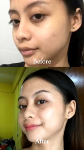 Prestige International Niacinamide Whitening Soap 75g: A Multi-Benefit Skincare Solution