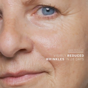 BABOR HSR Anti-Wrinkle Serum for Any Skin Against Wrinkles with Hyaluronic Acid & Panthenol (30ml)