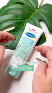 Cetaphil Gentle Clear Clarifying Acne Cream Cleanser | BPO Acne Cleaner 4.2oz