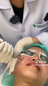 [E-coupon]  Discovery Pico Laser หน้าใส ไร้จุดด่างดำ ปรับผิวกระจ่างใส บอกลาความหมองคลำ ( เลเซอร์หน้าใส )