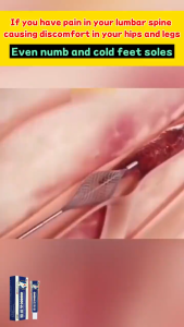 Lumbar spine cold compress gel Herbal Ingredients Relieve back pain leg pain muscle aches and pains