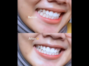 Arang Pemutih Gigi Teeth Whitening Actived Charcoal Powder dan Atasi Gigi Kuning Karang Bau AMPUH