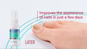 Japan Nail Fungal Treatment Nail Repair Essence Anti Fungal Spray Effectively Repair Damaged Nails Remove Onychomycosis Promote Nails Growth