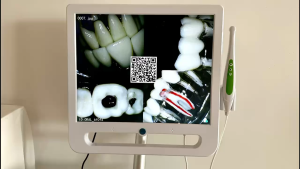 Dental Clinic Equipment: Intraoral Camera with LCD Monitor 17 Inch LCD Monitor 5.0MP USB with Bracket