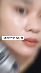 PAKET RK GLOW SKINBOOSTER ORIGINAL(GARANSI UANG KEMBALI)