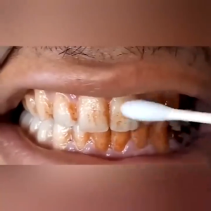 Tinh chất Làm Trắng Răng Loại Bỏ Vết Ố Trên Răng Tiện Dụng/10ML