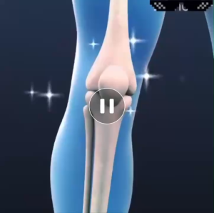 Kem Bôi Xoa Bóp Khớp Chân  Tay  Vai  Lưng  Đầu Gối Cải Thiện Khả Năng Vận Động Khớp