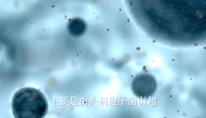 Devnen Shampoo Anti Ketombe Kelapa: Solusi Penghilang Ketombe & Gatal