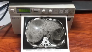 Kertas USG Sony UPP 110 HG: Solusi Profesional untuk Cetak Berkualitas Tinggi