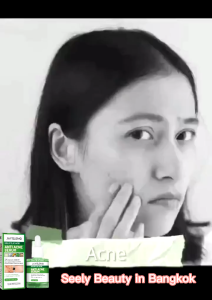 Jayusing เซรั่มแต้มสิ รูขุมขนกระชับ อ่อนโยนไม่ระคายเคือง ลบสิวโดยไม่ทิ้งรอย 30ml ครีมแต้มสิว