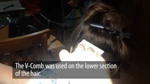 Sisir Serit Penghilang Kutu Rambut Dan Telurnya Berteknologi Terbaru