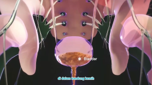Orthafit Bharata: Obat Gagal Ginjal & Cuci Darah ISK Infeksi Saluran Kemih