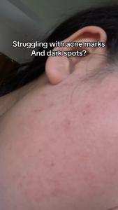 Vc exfoliating deep cleansing gentle and non irritating to remove dead skin can be used as a scrub all over the body