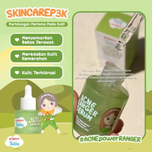 Pigeon Teens Acne Ranger || Facial Foam 40gr & 100gr || Moisturizer || Toner 100gr || Acne Gel 15gr || Acne Serum 20gr || Untuk kulit Berjerawat