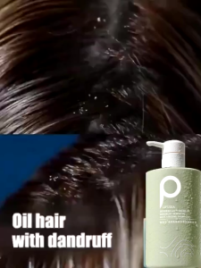 Shampo Garam Laut Anti Ketombe Pengontrol Minyak Lembut Halus Anti Tungau Wangi Tahan Lama