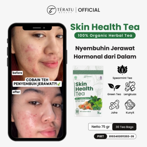 TERATU BEAUTY Skin Health Tea - 30 Tea Bag (Teh Herbal Spearmint untuk Jerawat Hormon dan PCOS)
