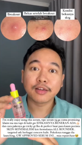 Emina GLORAD & Ultra HD Glow Series: Produk Perawatan Kulit Terbaik