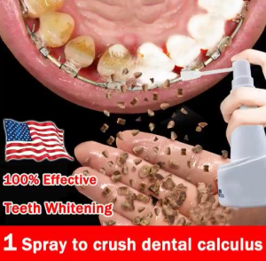 Pembersih Karang Gigi Tartar Remover For Teeth Whitening Stain Remover Tooth Cleaner Quickly Remove Dental Calculus In 3 Seconds