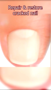 Nail Repair Essence Serum Original Serum Kuku | Perawatan Kuku Berjamur | Serum Penghilang Jamur Di Kuku | Vitamin Kuku Rusak | Memperbaiki Kuku Rusak