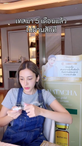 NATACHA เซรั่มเข็มเปิดผิวนาตาชา R-EX2 AMPOULE