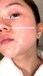 SKIN1004 Magadascar Centella Probio-Cica Intensive Ampoule 50ml