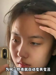 Ruyi 377 Whitening and Spot Removal Cream 儒意377美白祛斑面霜烟酰胺淡化色斑黄褐斑雀斑保湿淡斑/美白面膜睡眠免洗夜间377去黄气紧致涂抹式抗衰修复补水祛斑抗氧