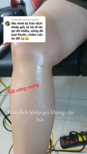 Gel xoa bóp thảo dược Ngựa Đỏ Kbauf - Hỗ trợ cơ - xương - khớp khỏe mạnh - 250ml