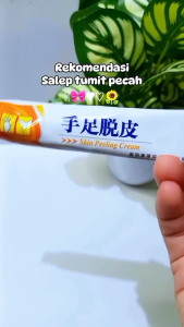 Salep Kaki Pecah - Pecah Dan Kering Skin Peeling Cream Tangan Anti Keriput Obat Tumit Kasar Kapalan