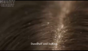 500ML Sea Salt Anti Dandruff Shampoo Amino Acid Shampoo For Scalp Itching Scalp And Dandruff For Men & Women Anti Hair