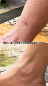 Sabun Mabello Bedda Lotong: Pemutih Kulit Alami & Organik