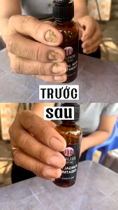 Serum Nấm Móng Thảo Dược Eelhoe Hoa Kì - Tinh Chất Eelhoe Dưỡng Móng Phục Hồi Mô Chăm Sóc Móng