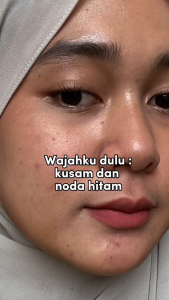 Amura Day Cream Ultra Ageless Skincare Anti Aging Mengencangkan Kulit Melawan Tanda Penuaan Pencerah Kulit Wajah Glowing Penghilang Flek Hitam Penghilang Jerawat Penghilang Bekas Jerawat Penghilang Milia Penghilang Beruntusan
