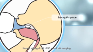 HUKI Botol Susu Bayi 240ml dengan Dot BULAT Nipple Bulat