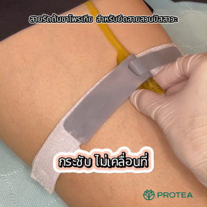 สายรัดต้นขาโพรเทีย สำหรับยึดสายสวนปัสสาวะ