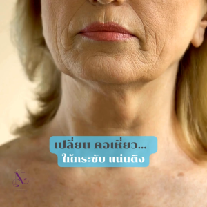 แอสตาแซนธิน เอจ-ดีไฟอิ้ง เนค ครีมทาคอกิฟฟารีน กระชับคอ neck cream giffarine