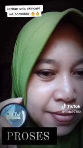 Paket Hemat Unic Skincare & Sunscreen (Garansi Uang Kembali)