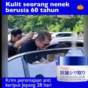 Japan Krim Wajah Anti Whitening Freckle Cream Krim Pemutih Penghilang Bintik Wajah Krim Asli Efektif Menghilangkan Bintik Hitam Anti Penuaan Pengencangan