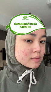 Mako By Seris Moisturizer Fresh Glowy Skin Day & Night Cream 20gr Pelembab Pengilangan Bekas Jerawat Wajah Berjerawat dan Bruntusan
