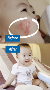 LABO Nutrition Biogenics 16 Predigested Probiotics for IBS Digestive Balance Bowel Regularity Immunity Diarrhoea Constipation Cleanse Colon & Eczema Supplement • Made in Japan • 15 Sachets