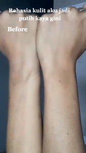 Precious Skin Thailand Alpha Arbutin 2 In 1 AHA Serum Booster Set 100ML / Lotion / Serum / AHA Mimi